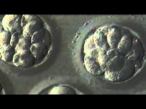 5-Day Blastocyst Transfer