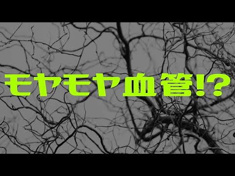 【痛みの原因】モヤモヤ血管とは!?