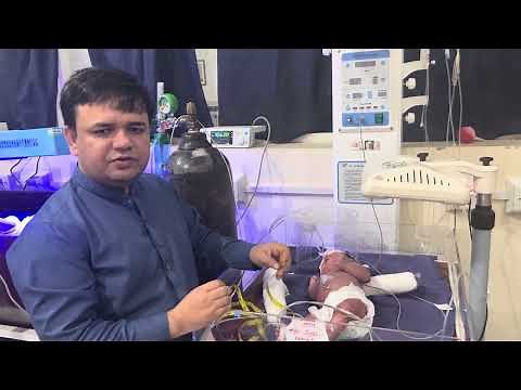 How to Measure Abdominal Girth or Circumference