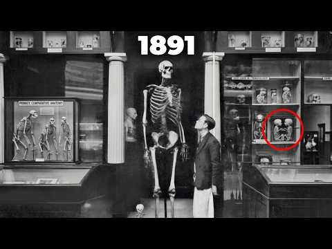 The Last Doctor Who Measured a Living Giant — What His Medical File Said Before It Was Destroyed