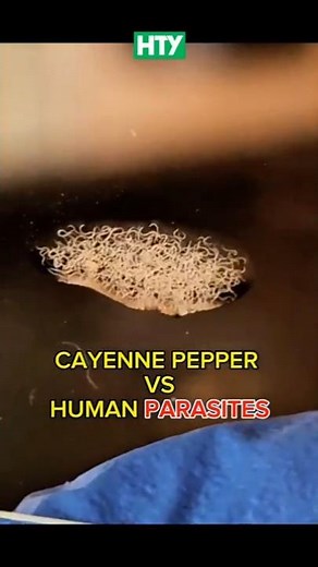 Cayenne Pepper vs. Parasitic Worms – You Won’t Believe This! 🍍🧬