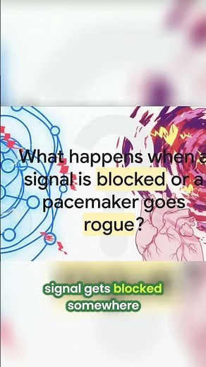 Heart Block & Ectopic Pacemakers: When Signals Go Wrong #shorts