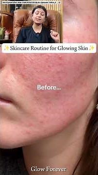 चेहरे की Dullness के लिए मुलेठी का नुस्खा by Dr Upasana #skincare #glowingskin #pigmentation #acne