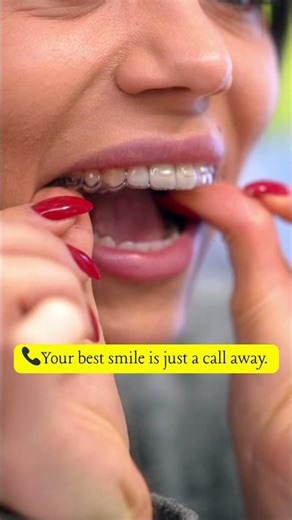 Your Best Smile is Just a Call Away | Choose Transpera Aligners Today! 😁 #clearaligners #dentist