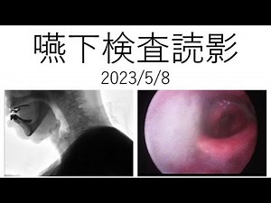 嚥下造影検査/嚥下内視鏡検査読影エキスパート