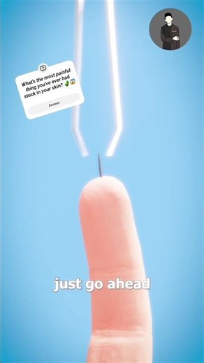 How Your Body Pushes Out Splinters! 😲 #shorts