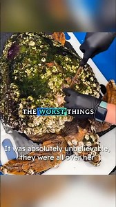 Why Barnacles covers around sea turtles 🤔