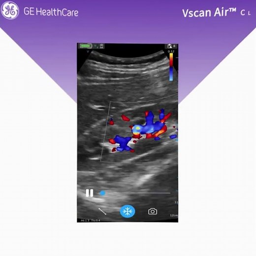 Vscan AIR™ CL may help you quickly decide on next steps, potentially saving precious time.