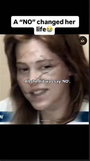 Conspiracy Theories on Instagram: "In 1986, model Marla Hanson made a statement that shocked the public: “I didn’t wear makeup because I wanted people to see what they had done.” That summer, the 24-year-old New Yorker rejected unwanted advances from her landlord, Steve Roth, after a dispute over a security deposit. In retaliation, Roth hired two men to attack her. Court testimony revealed he lured Hanson outside a bar, where the men staged a fake robbery and slashed her face with razors. She su