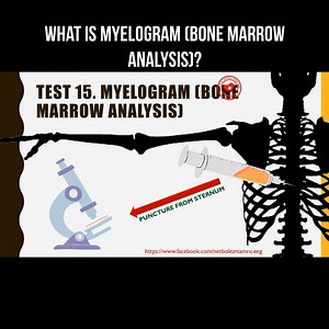 What is myelogram (bone marrow analysis)? #myelogram #bonemarrow | About health and science in simple words