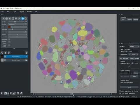 End To End Pipeline: SSRL/ALCF