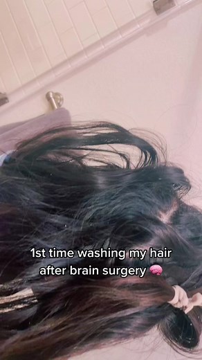 Hair Styling Tips After Brain Surgery