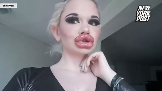 22-year-old Barbie wants the biggest lips in the world