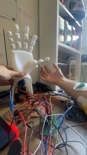 #protesis #bionicas #arms #legs #brazos #impresion #3d #impresion3d #pacientessatisfechos #tecnologia #cursos #servos ##diseñospersonalizados | Somos Mecatrónica