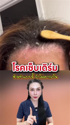 วิธีหลีกเลี่ยง 'เซ็บเดิร์ม' ด้วยมอยส์เจอร์ไรเซอร์