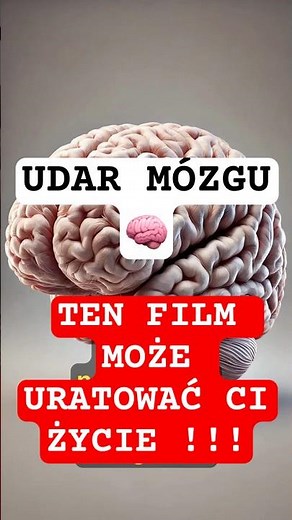 TO DZIEJE SIĘ Z TWOIM CIEŁEM KIEDY MASZ UDAR !!!!! - Jakie są objawy udaru? #zdrowie #udar