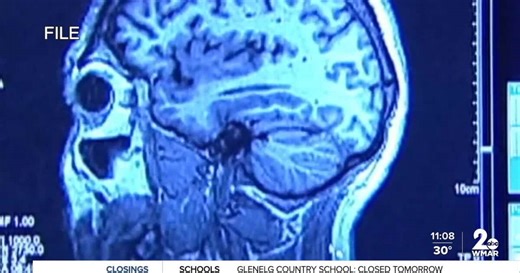 Medical Researchers react to Trump administration's push to cap NIH funding