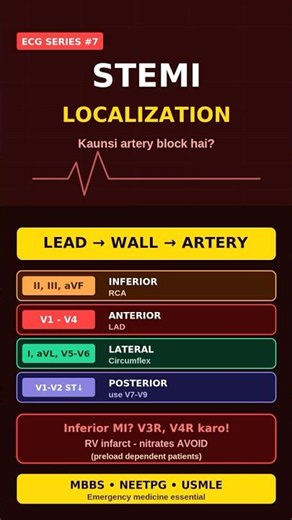 STEMI LOCALISATION #STEMI #ECG #Cardiology #MyocardialInfarction #MedicalStudent #MBBS #NEETPG #FMGE
