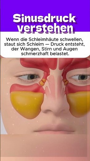 Sinusdruck verstehen