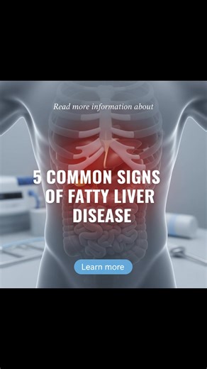 Learn about common signs that some people notice when exploring information related to fatty liver disease. | Global News Network