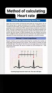 70K views · 453 reactions | Method of calculating heart rate from ECG | Anesthesia&Emergency Medicine | Facebook