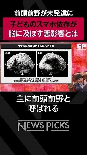 【スマホ依存】子供の脳に及ぼす影響　#shorts