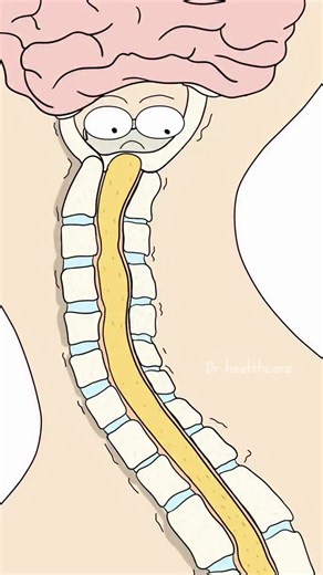 Dr.Healthcare on Instagram: "Why Bad Posture Turns Into a Tech Neck Hump?"