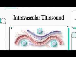 032 Intravascular Ultrasound