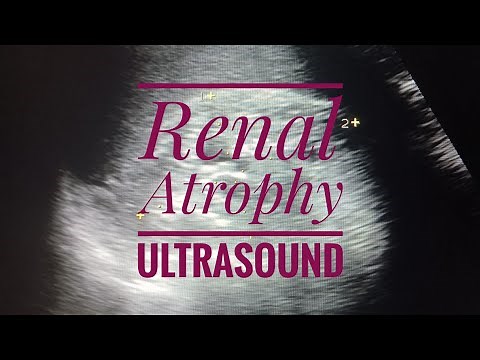 Renal Atrophy Ultrasound