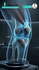 Knee Pain? Learn How to Keep Your Knees Healthy & Strong | Expert Tips #orthopediccare