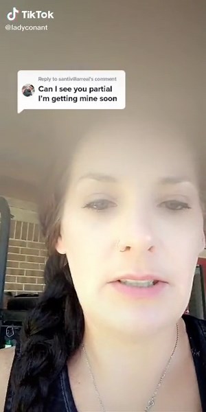 Adjusting to Partial Dentures: My Experience with Tilly Conant