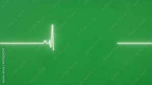 Heartbeat Line on Green Screen Monitor Life and Health