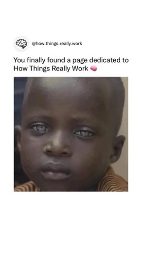 How Things Really Work on Instagram: "Only about 3% of the world’s population has gray eyes, making them one of the rarest natural eye colors globally. Gray eyes appear this way because light scatters through low amounts of melanin in the iris, creating a silvery or smoky effect that shifts with lighting. This scattering makes the color look incredibly unique. Because the global population is around eight billion, only a few hundred million people have this trait. Their eye structure doesn’t con