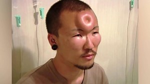 Uncomfortable images guaranteed to trigger visceral reactions of embarrassment