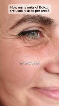 Botox: Average units of botox