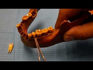 buccal objective rule (SLOP) (clark's technique) X-Ray عربي