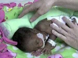 Right Sidelying Position / Positioning NICU patients with The Zaky / Instructional Video