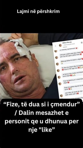 “Fize, të dua si i çmendur” / Dalin mesazhet e personit qe u dhunua per nje "like”