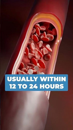 Colchicine as a gout treatment. #gout #colchicine