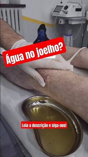 ÁGUA NO JOELHO: O Que É, Causas, Sintomas e Tratamento! Derrame Articular Explicado #shorts #short