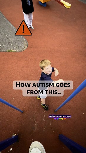 The part of autism I’d take away!. Head banging in individuals with autism is a self-injurious behavior often used for self-soothing or communication, particularly when experiencing sensory overload, anxiety, or frustration. While it can be a normal behavior for some infants, persistent or severe head banging in individuals with autism warrants attention to identify underlying causes and potential interventions.This right here is the sole reason l've softened my sitting room. Arlo doesn't do thi
