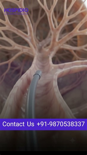 Prostate Artery Embolization Explained: Non-Surgical Fix for an Enlarged Prostate | Short Explainers