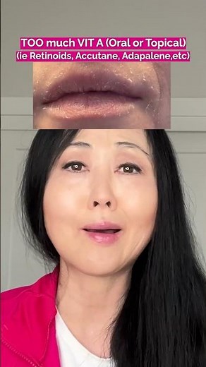 WHY You STILL HAVE CONSTANTLY PEELING LIPS #chappedlips