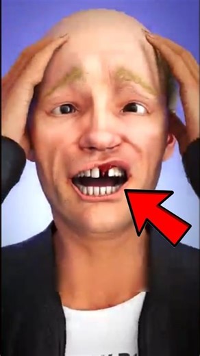 What To Do If Your Tooth Gets Knocked Out