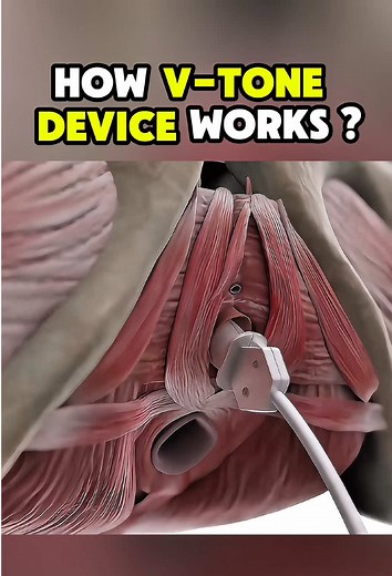 Enhance Pelvic Health with V-Tone Device