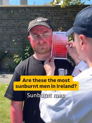 “This is very dangerous”☀️ This is footage from this years ‘Most Sunburnt Men in Ireland’ competition 👀 #ireland #dublin #irish