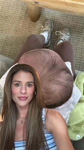 McKenzie shared her baby’s incredible transformation — and we couldn’t be more proud of their journey. 💛 When her little one was diagnosed with torticollis and had severe plagiocephaly, McKenzie was preparing to move forward with a helmet… until she discovered the Perfect Noggin. She calls it the best decision she made — and just look at these amazing results! ✨ Seeing families find something that truly supports their baby’s comfort and alignment means everything to us. Want to learn more about