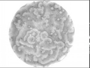 Dictyostelium discoideum, axenic strain, aggregation on a petri dish