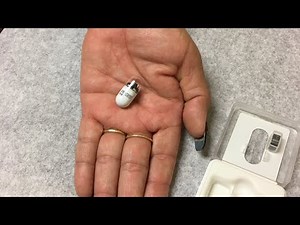 My experience with Capsule Endoscopy 11/2019 #pillcam #capsuleendoscopy