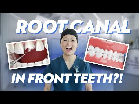 Your Front Tooth Needs a Root Canal Treatment? Here's Everything